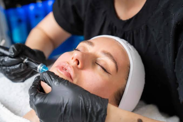 HydraFacial in London: The Skin Treatment With a Cult Following